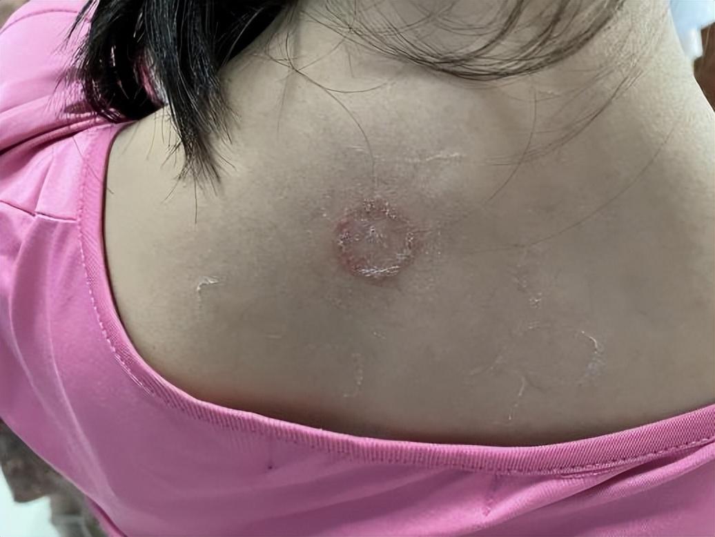 尤卓爾軟膏價(jià)格大解密，重磅揭秘真實(shí)價(jià)格??