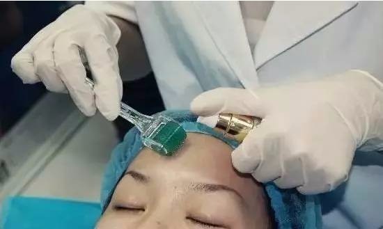 果酸換膚成本與代價(jià)揭秘，美麗背后的價(jià)格標(biāo)簽