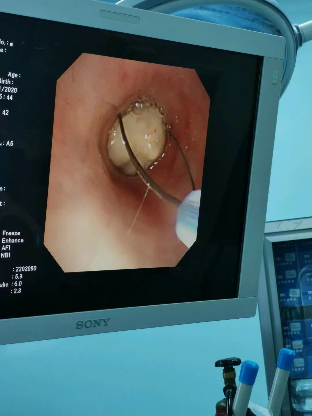 電子鼻咽喉鏡價格的市場定位分析，多元因素下的市場趨勢探討