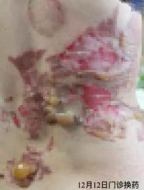 小巷特色養(yǎng)生館，最新拔罐圖片分享