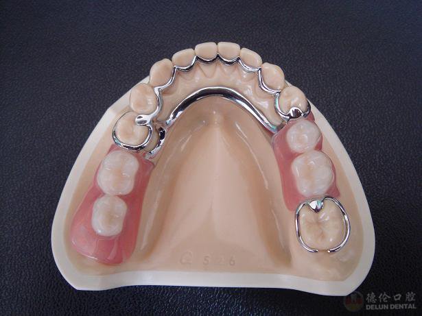 關(guān)于活動假牙價格的探討與解析