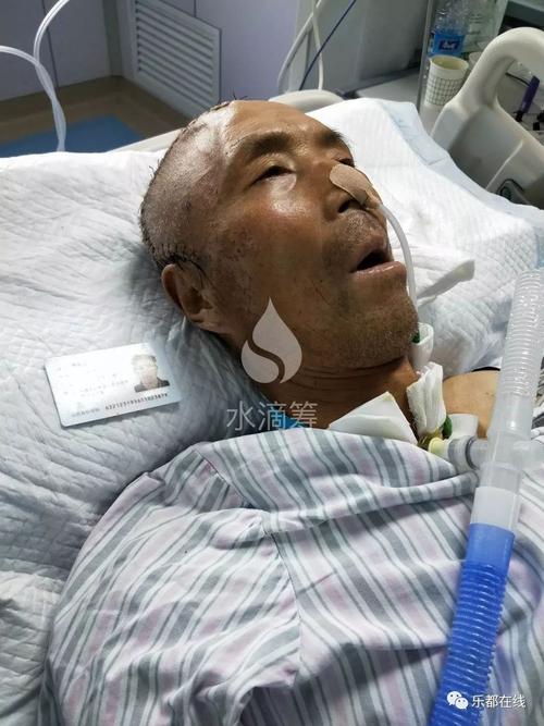 馮現(xiàn)學(xué)腦出血最新消息及應(yīng)對幫助指南（初學(xué)者與進(jìn)階用戶參考）