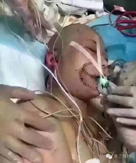 被虎咬的女子的最新消息，日常中的奇遇時刻